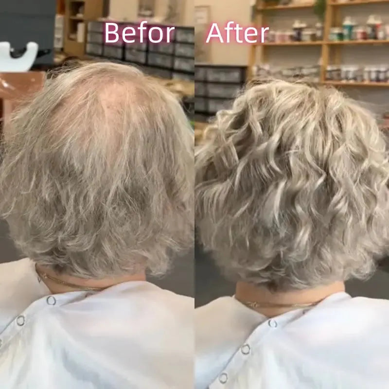 Hot Sale Curly Hair Toppers for Women with Thinning Hair-Cover Grays, Boost Volume